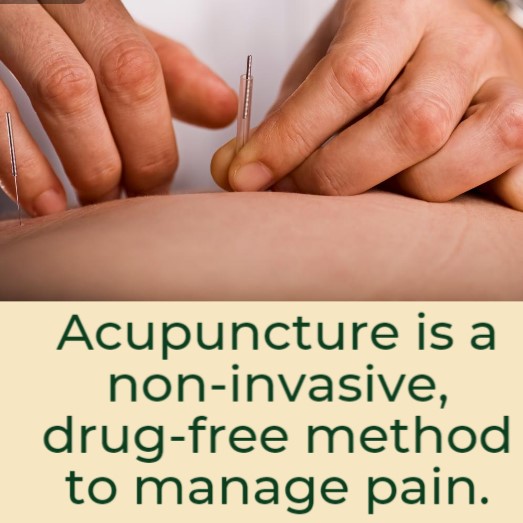 Acupuncture can help you with stress relief and pain management