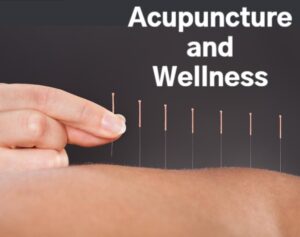 Acupuncture & Wellness