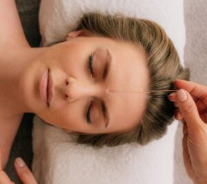 Cosmetic Acupuncture and Facial Enhancement at De-Stress: Acupuncture & Facial Rejuvenation Clinic of Dover