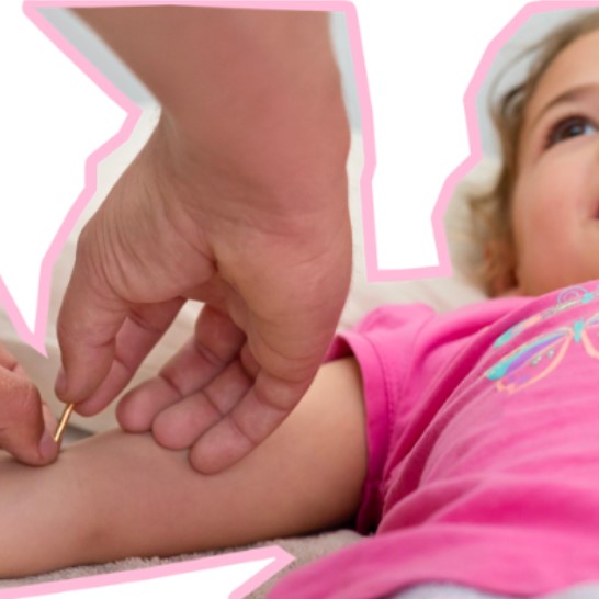 Child getting stress relief with acupuncture